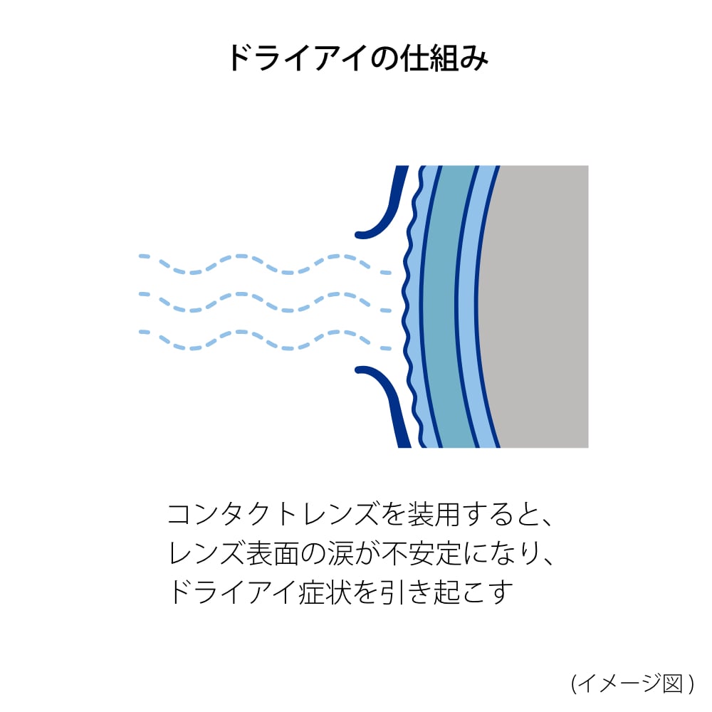 かすみ目とは 目がかすむのはなぜ アキュビュー 公式