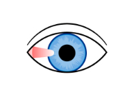 目の充血にはさまざまな種類があるのをご存知ですか アキュビュー 公式